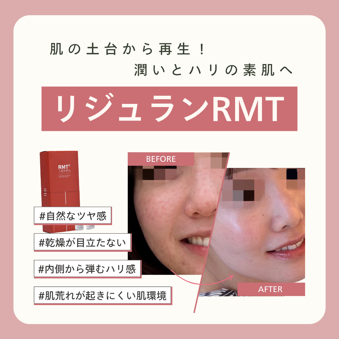ピックアップ6